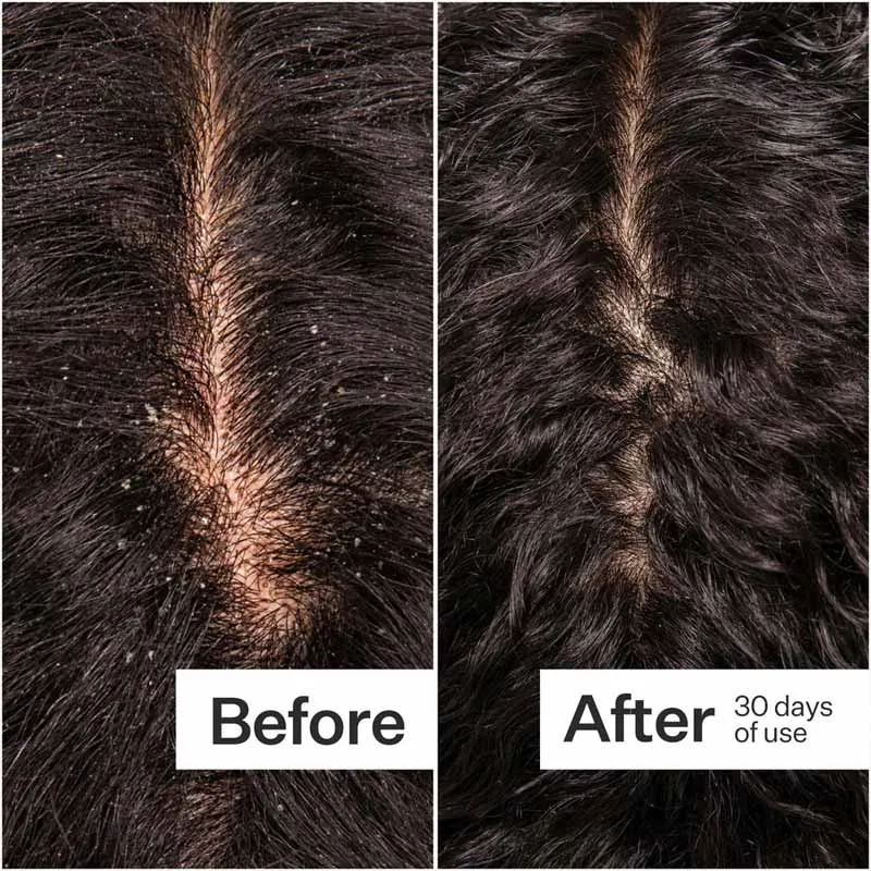 Act Acre Microbiome Cooling Scalp Serum