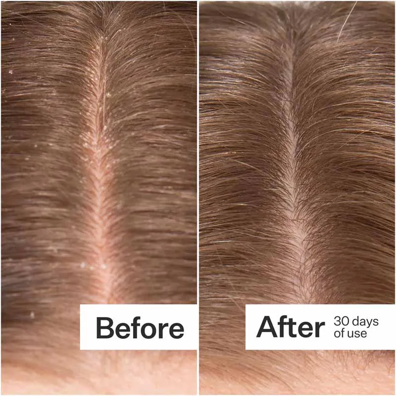 Act Acre Microbiome Cooling Scalp Serum