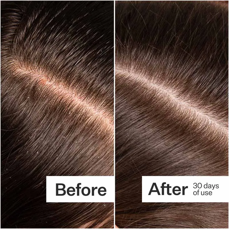 Act Acre Microbiome Cooling Scalp Serum